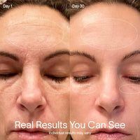 Radiant Glow 4-in-1 Wand™
