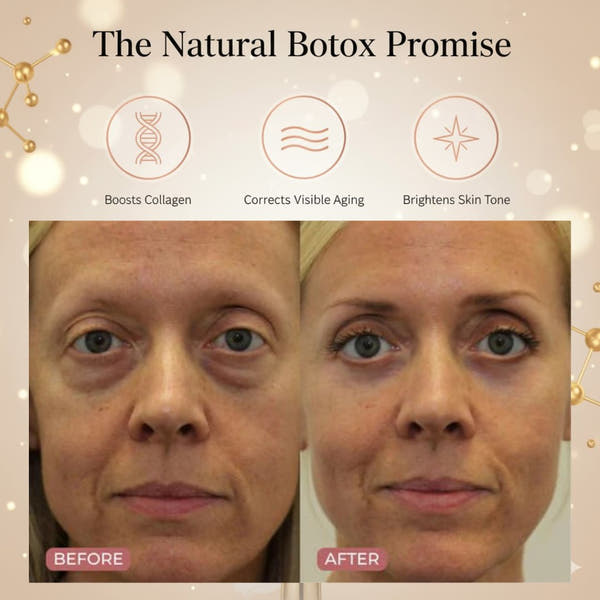 Glow Bee Venom Lotion™