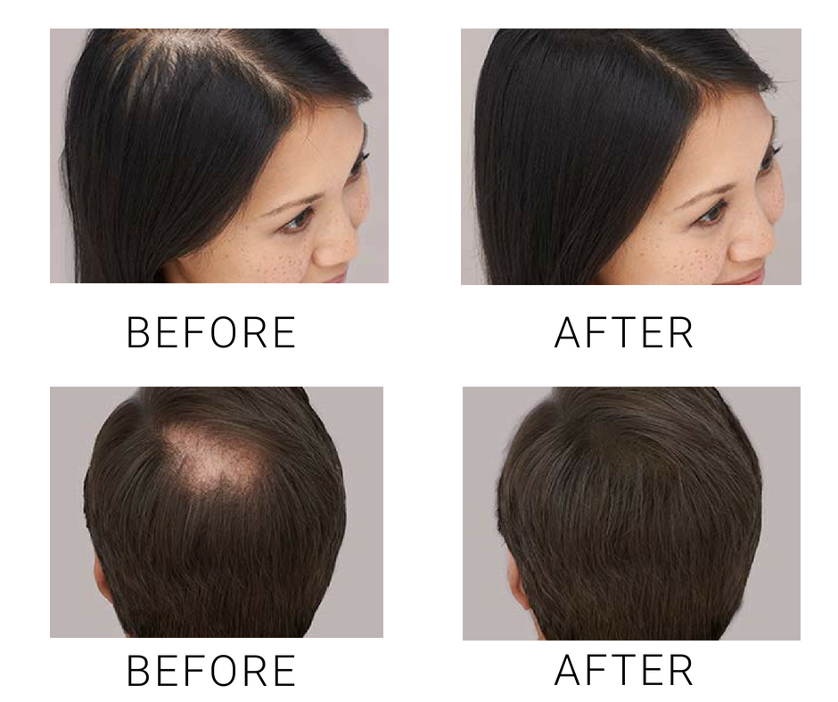 NEW TOPPIK Hair Building Fibers